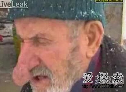 (上图)最长的胡子    4,最长的鼻子   这位名叫穆罕默特·古力